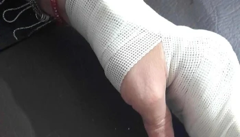Sophie Carmagnac. Terapia Ocupacional. Rehabilitacion de mano y miembros superiores. Confección de férulas - Córdoba
