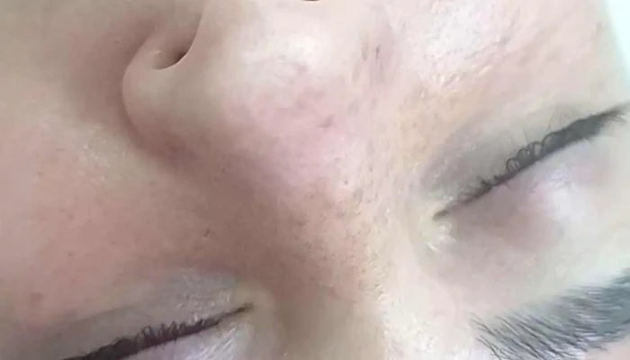 Consultorio Kinesiologia Dermatofuncional Licroxana Emaidana Videos - Río Segundo
