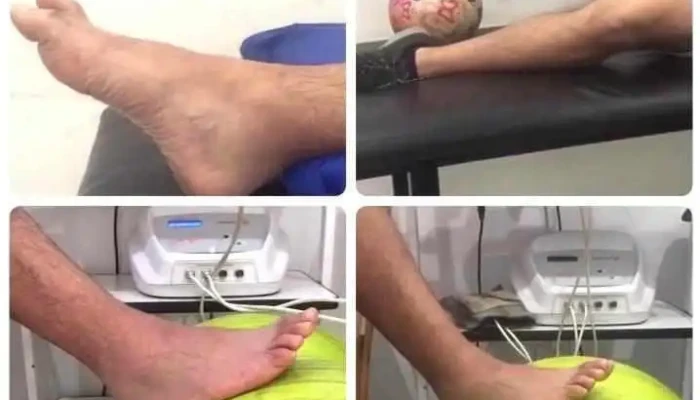 Fisioterapia Arguello Kinesiologia Villa Allende -  Videos - Córdoba